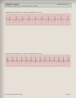 ECG readout, page 10