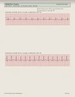 ECG readout, page 12