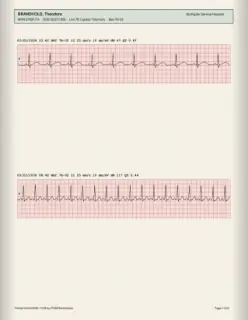 ECG readout, page 13
