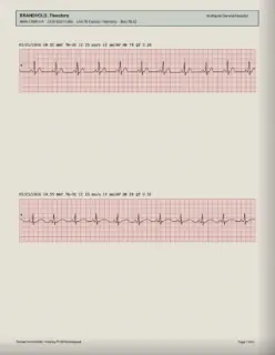 ECG readout, page 14