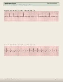 ECG readout, page 15