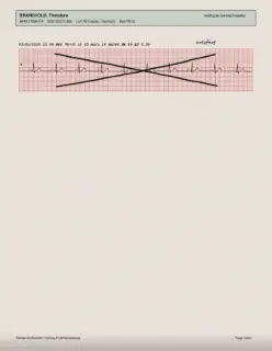 ECG readout, page 16