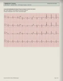 ECG readout, page 17