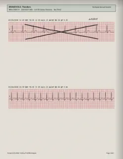 ECG readout, page 18