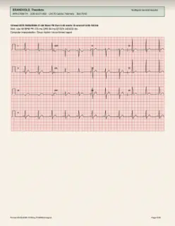 ECG readout, page 6