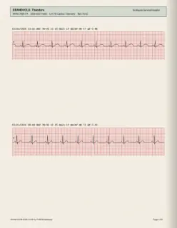 ECG readout, page 7