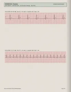 ECG readout, page 8