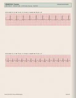 ECG readout, page 9