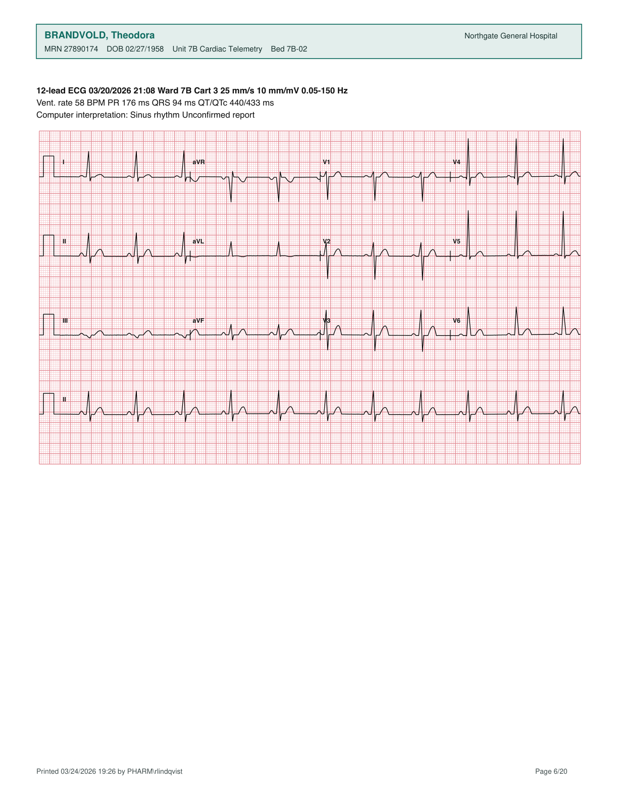 Clean ecg readout layout