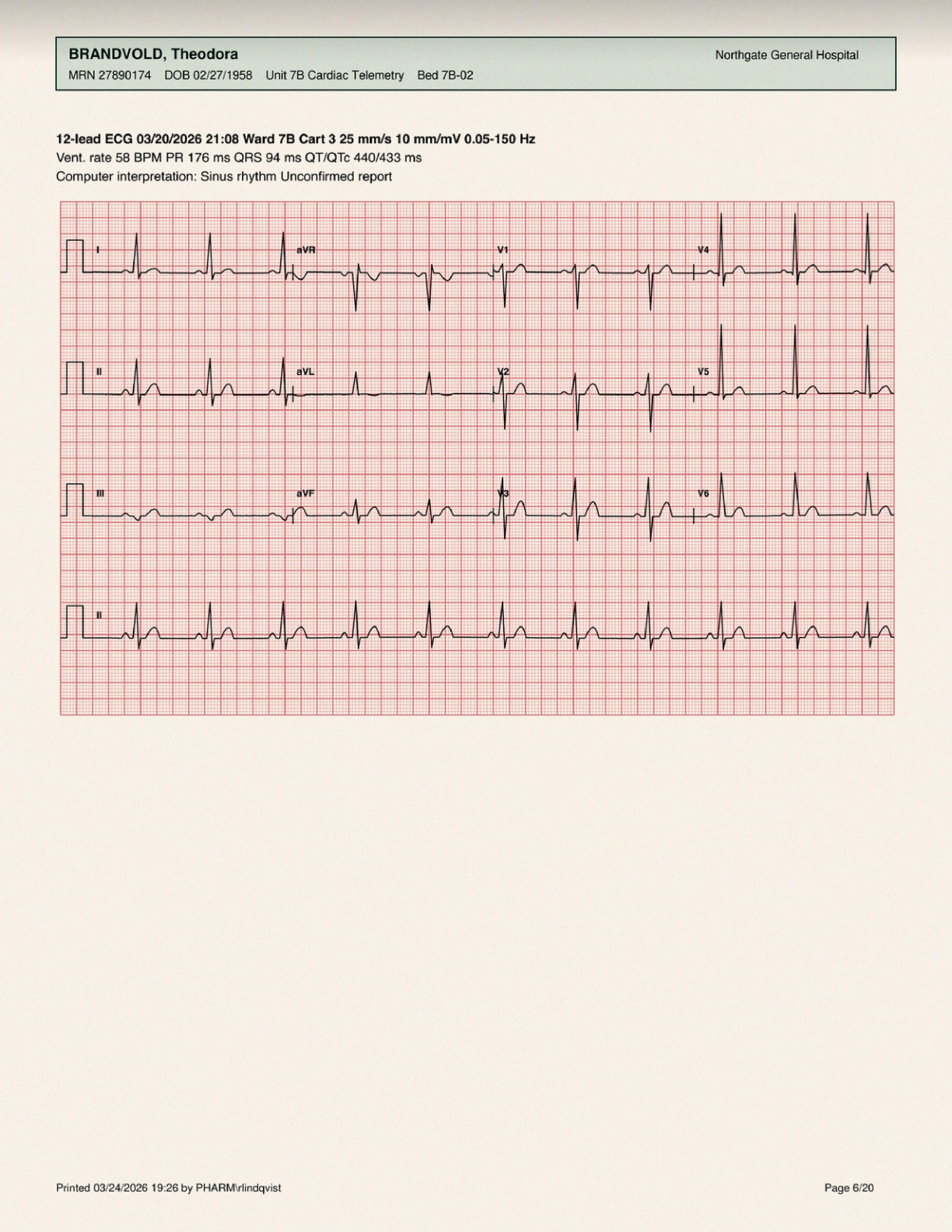 ECG readout, actual dataset page 6
